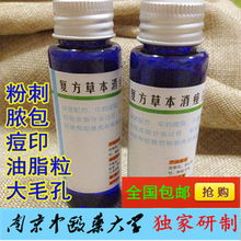 中药祛痘产品前五强 科学祛痘，收细毛孔，告别粉刺痤疮